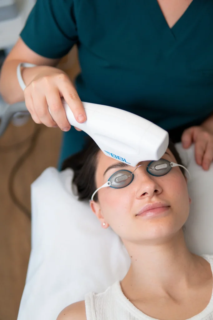 BBL handpiece used during a facial treatment