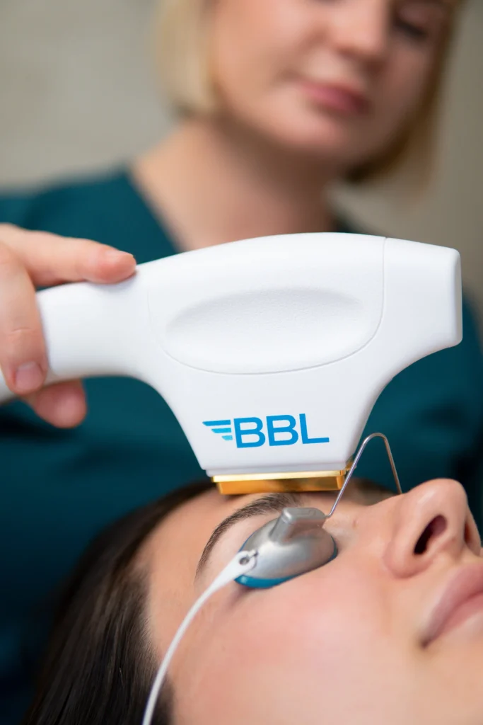 Close view of the BBL handpiece beside a client