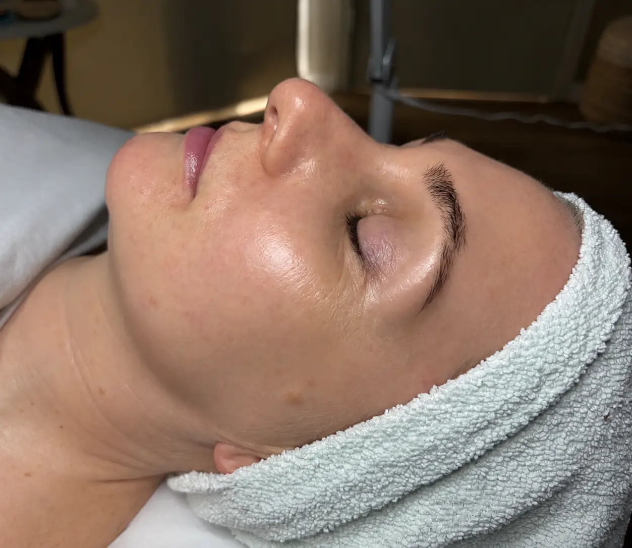Client skin after a personalized facial treatment at Topaz Facial Studio